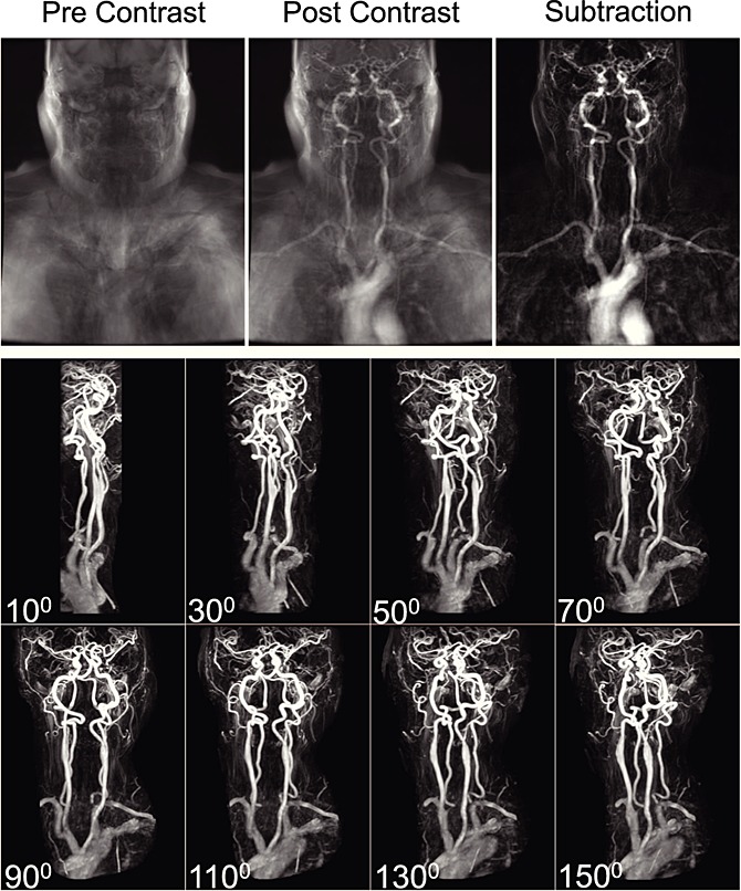 Image for Cerebrovascular Magnetic Resonance Imaging: A Review of State-of-the-Art Approaches, Methods and Techniques