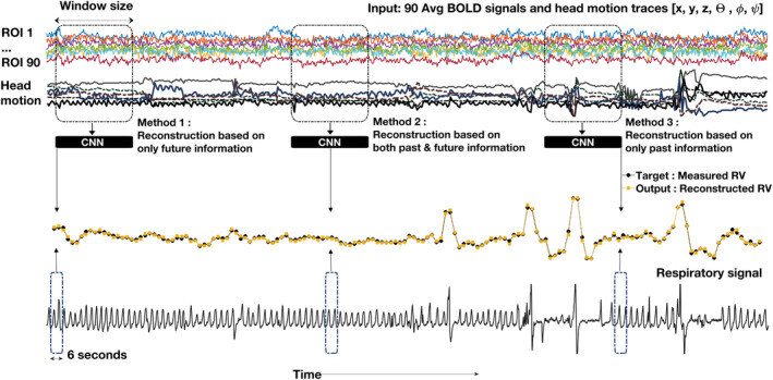 Image for Machine Learning-based Estimation of Respiratory Fluctuations in a Healthy Adult Population using BOLD fMRI and Head Motion Parameters