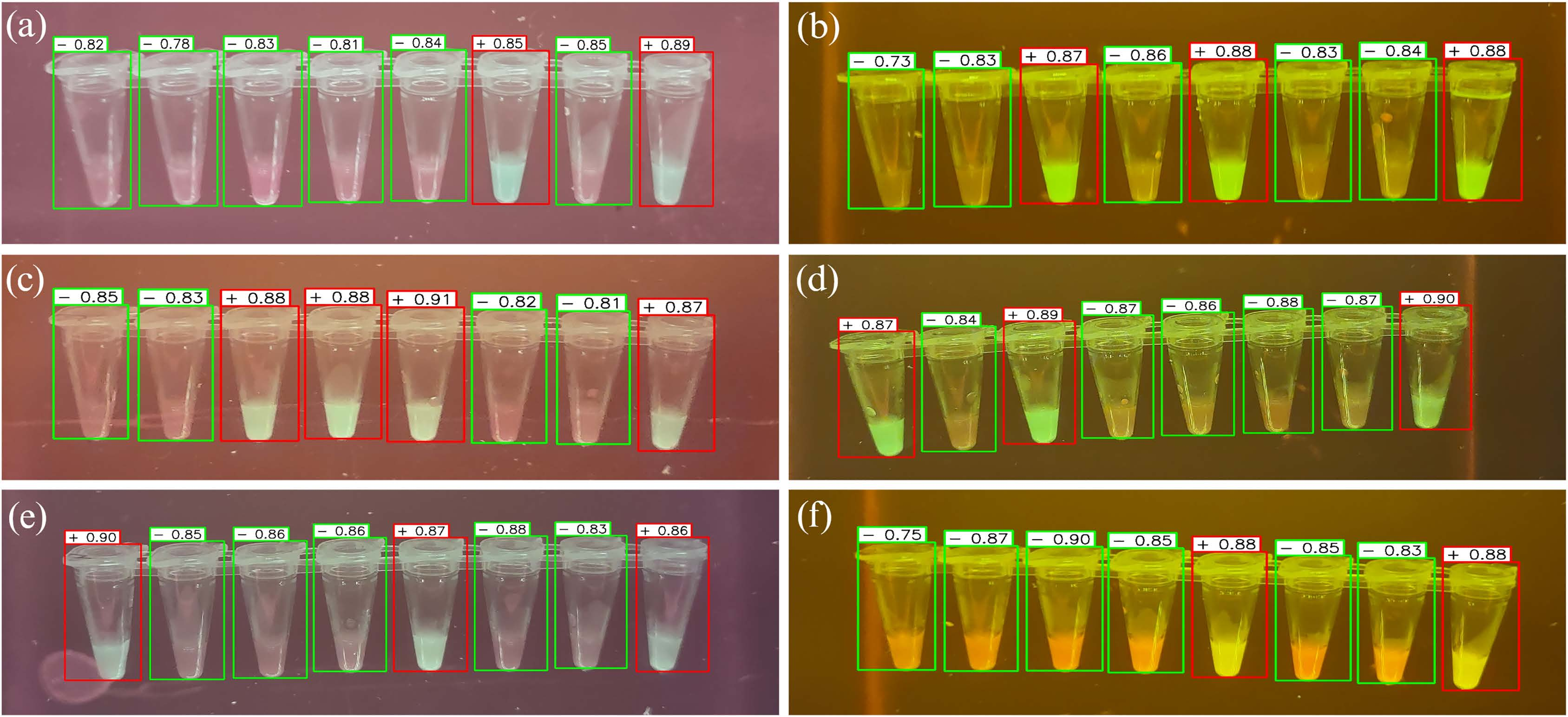 Image for You Only Look Once (YOLO) Based Machine Learning Algorithm for Real-Time Detection of Loop-Mediated Isothermal Amplification (LAMP) Diagnostics